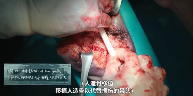 国产医疗剧想出经典,先学会“抄作业”-第7张图片-ZBLOG 医学团队 分集_医疗剧评价_国产医疗剧与国外医疗剧对比